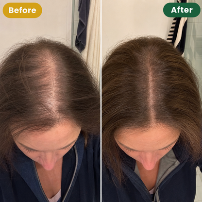 Peptide Hair Growth Serum